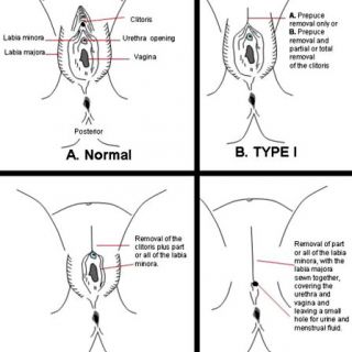 Types of FGM